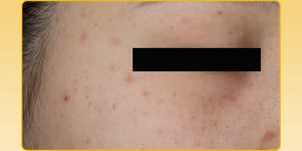 [잡티저격/TXA] 퍼셀 80억/mL 글루타치온 TXA 캡슐 크림 80ml 상세페이지 15